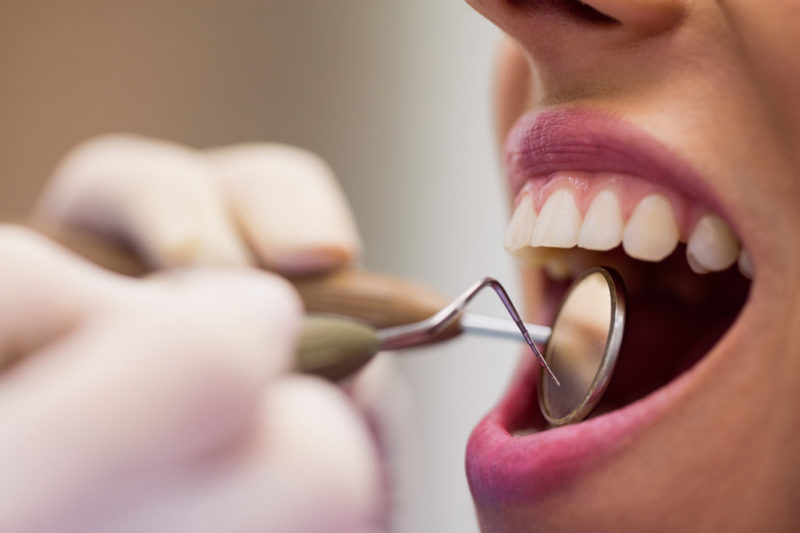 gingivitis clinica dental Cuevas Queipo